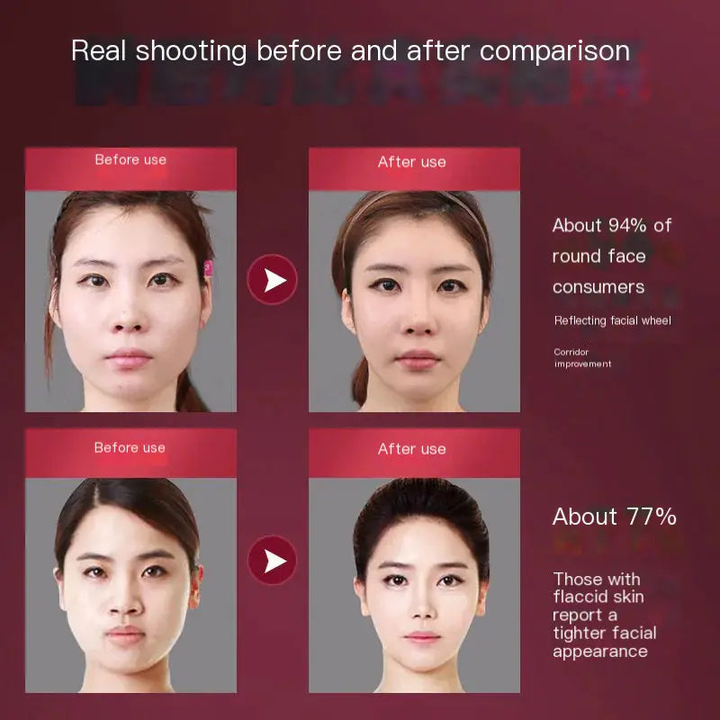 Facial Slimming Device for Chin and Jawline Contouring