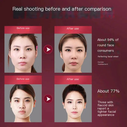 Facial Slimming Device for Chin and Jawline Contouring